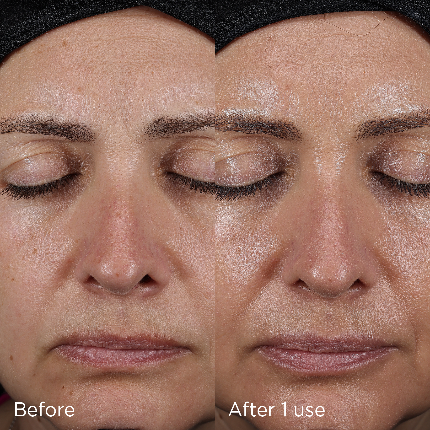 DAILY PREVENTION advanced smartblend SPF 75