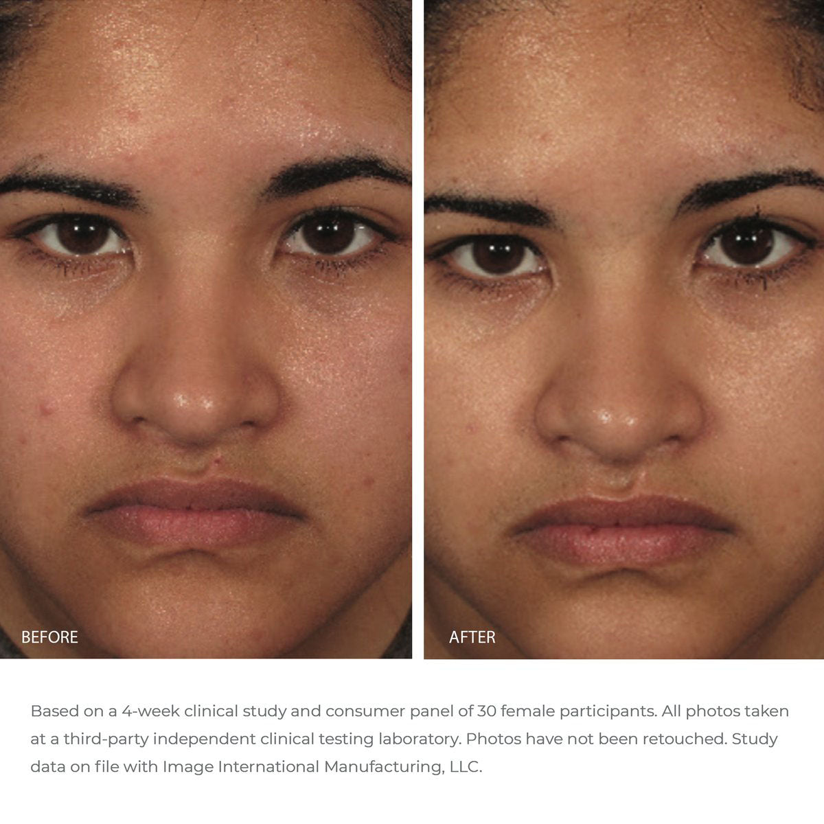 Before and after comparison of a woman's face with text about a clinical study.