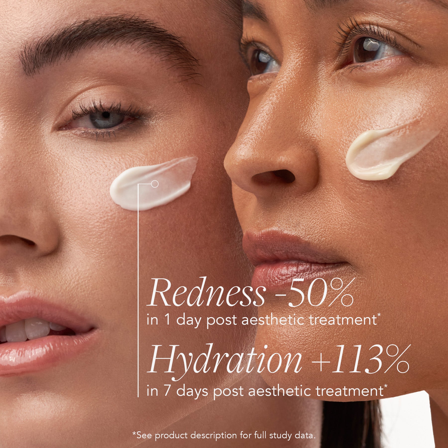 Two women with skincare product on their faces, showing improvement in redness and hydration.