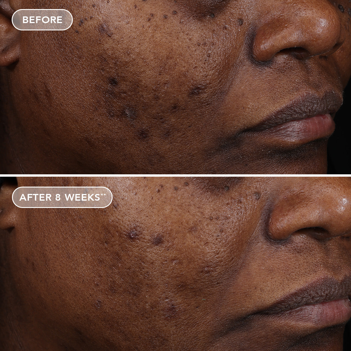AGELESS+ retinol treatment crème 1.2% retinol complex