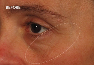 Before image