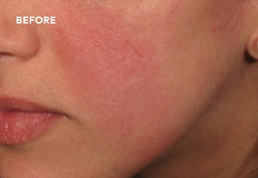 Before image
