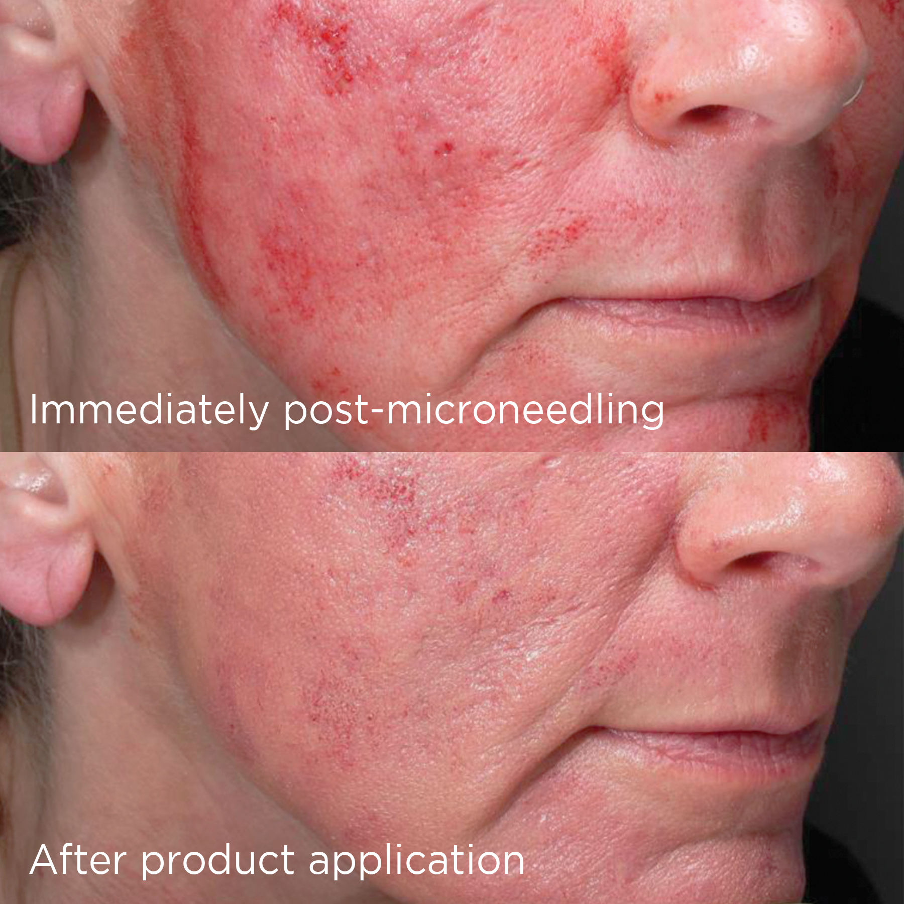 DAILY PREVENTION advanced smartblend SPF 75