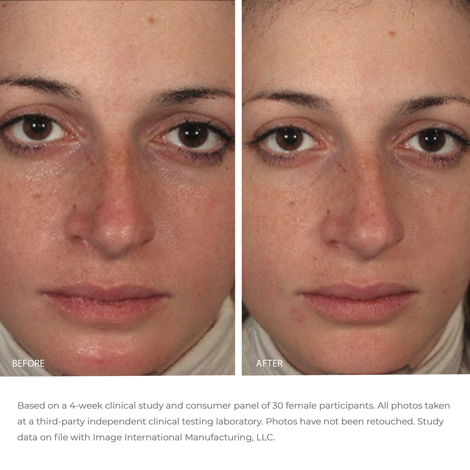 ORMEDIC Balancing Gel Masque Samples (5 pack)